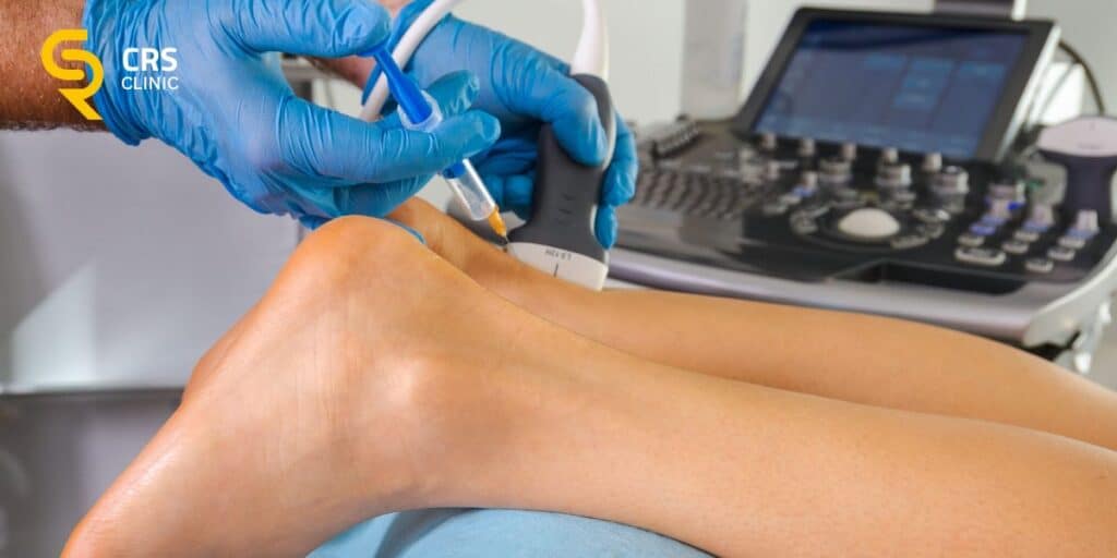 Lekarz ortopeda wykonuje hydrodysekcję ścięgna Achillesa w CRS Clinic w Warszawie