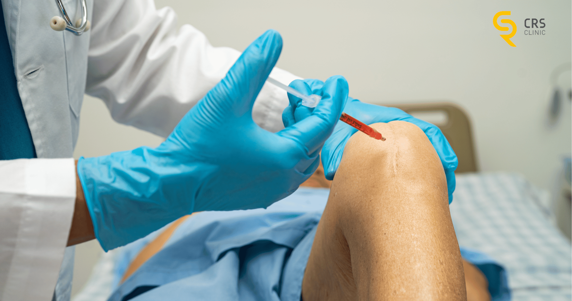 kwas hialuronowy do kolana