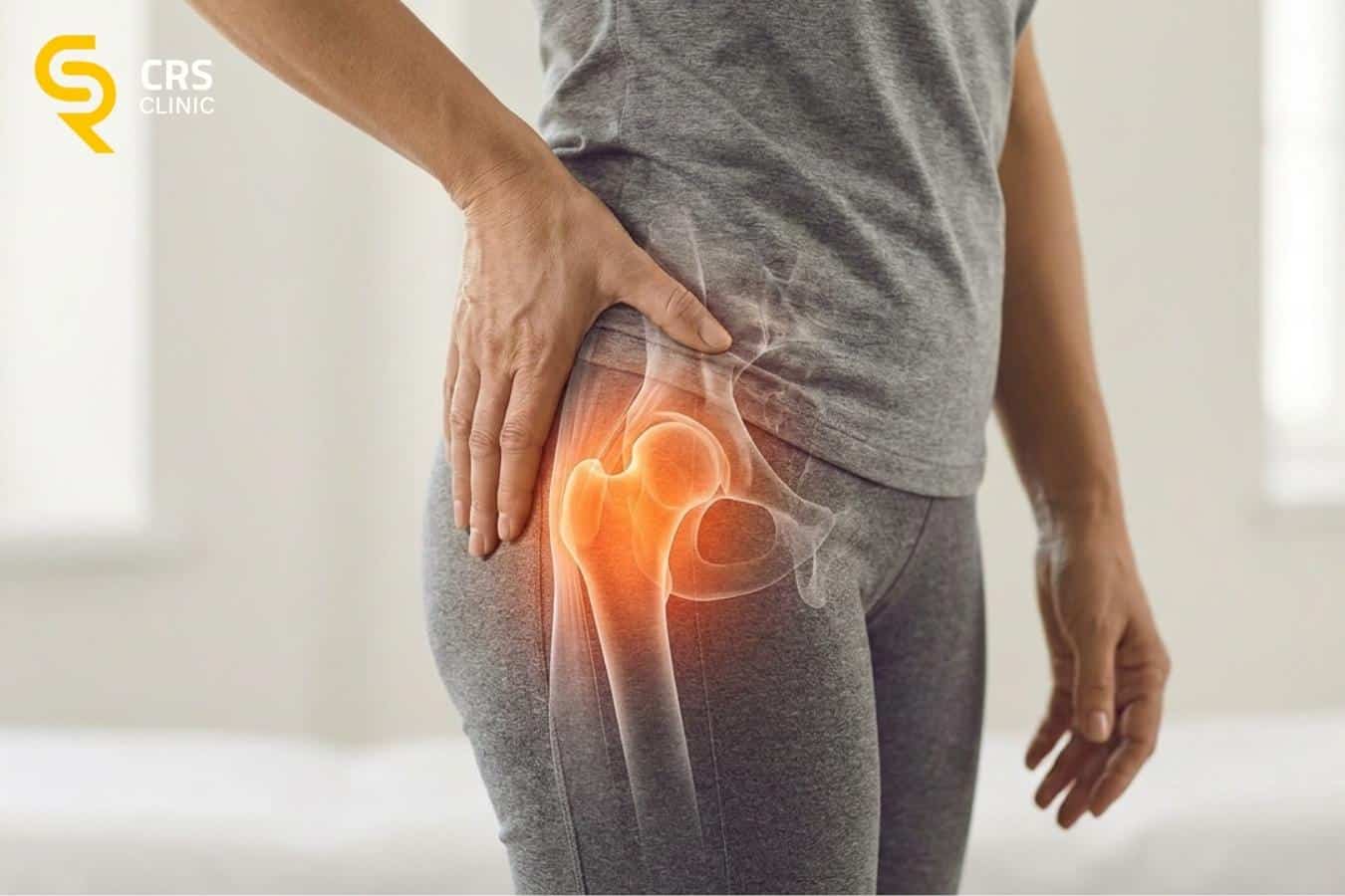 Pacjentka w gabinecie ortopedycznym z wyraźnie zaznaczonym anatomicznie miejscem bólu biodra