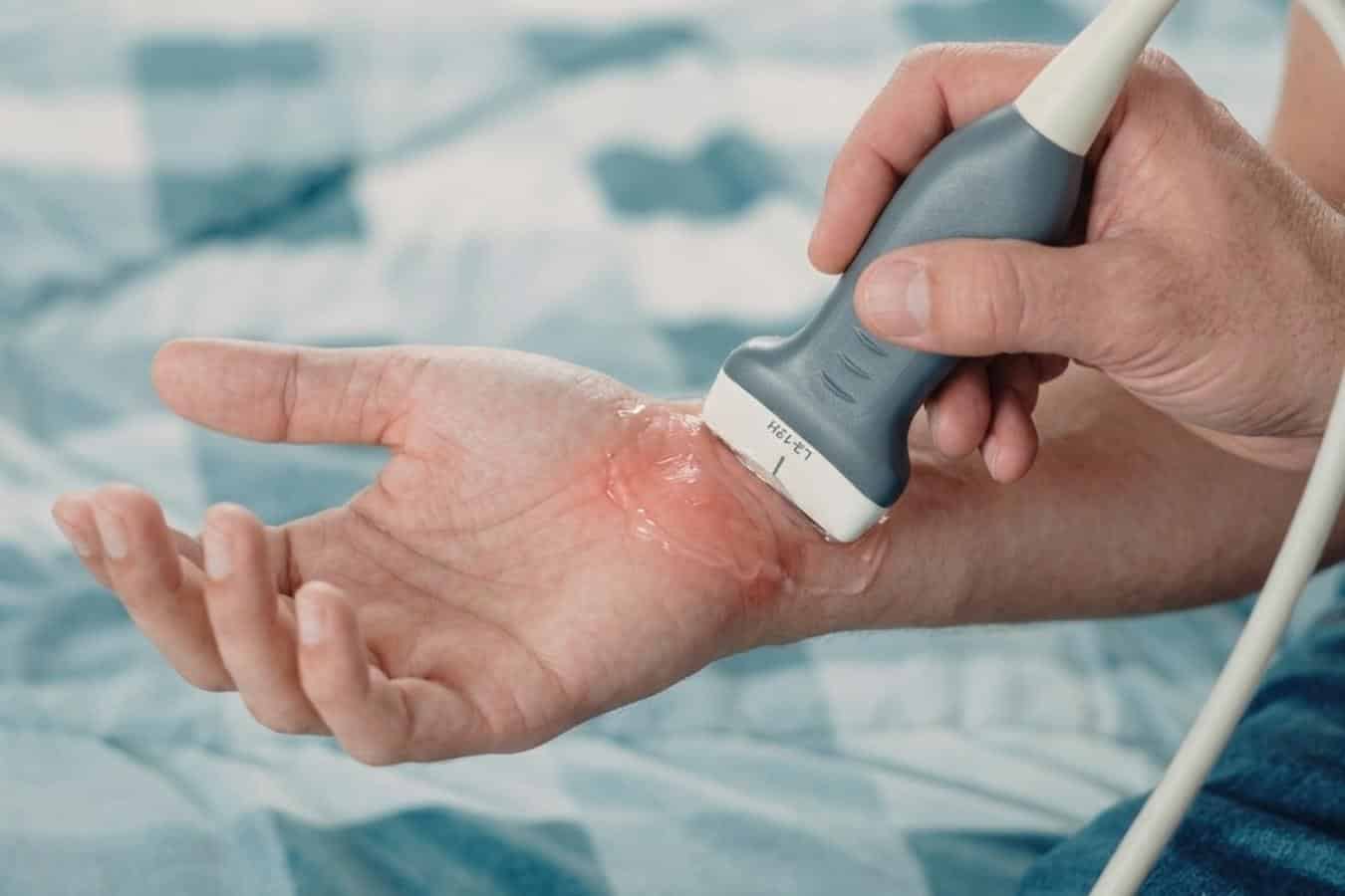 Lekarz ortopeda wykonuje badanie USG w kierunku choroby de Quervaina w CRS Clinic Warszawa