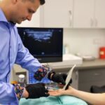 Lekarz ortopeda wykonuje małoinwazyjny zabieg Microtomii palca