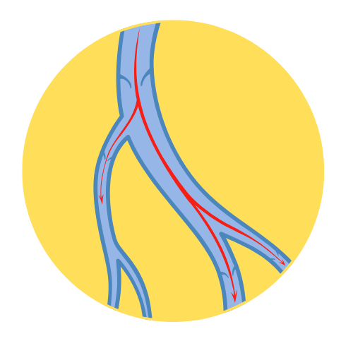 problemy naczyniowe a ból łowy
