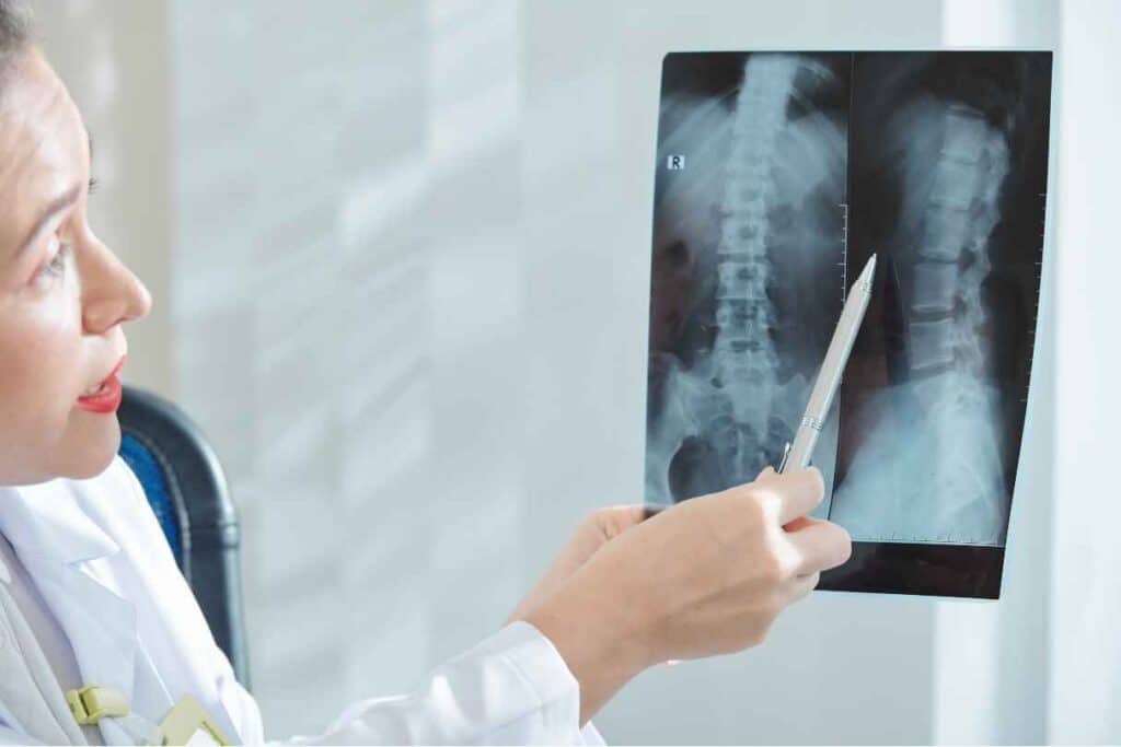 Doktorka sprawdza wyniki RTG kręgosłupa dziecka