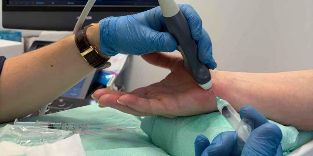Lekarz ortopeda w CRS Clinic Warszawa przeprowadza nieoperacyjny zabieg hydrodekompresji cieśni nadgarstka