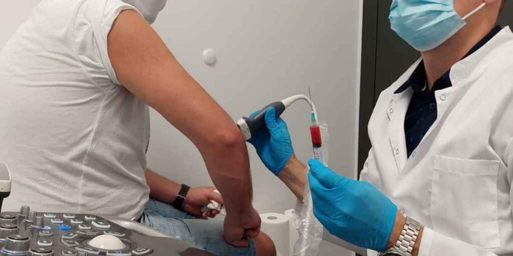 Lekarz ortopeda wykonuje zabieg podania osocza bogatopłytkowego (PRP) w CRS Clinic Warszawa