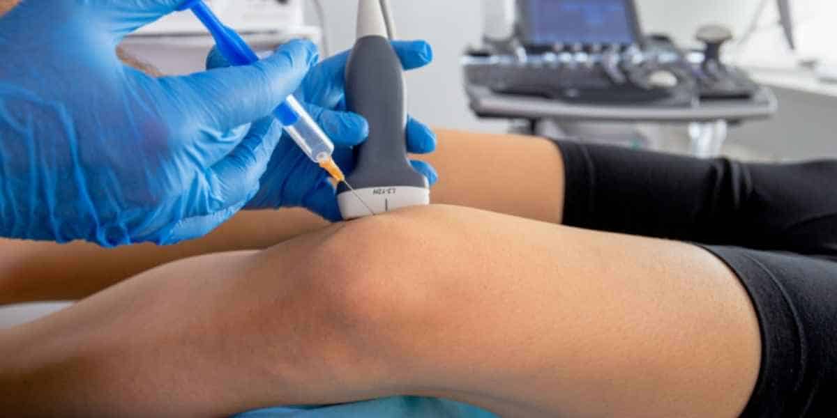 Lekarz ortopeda wykonuje zabieg podania osocza pogatopłytkowego (PRP) w kolano w CRS Clinic Warszawa