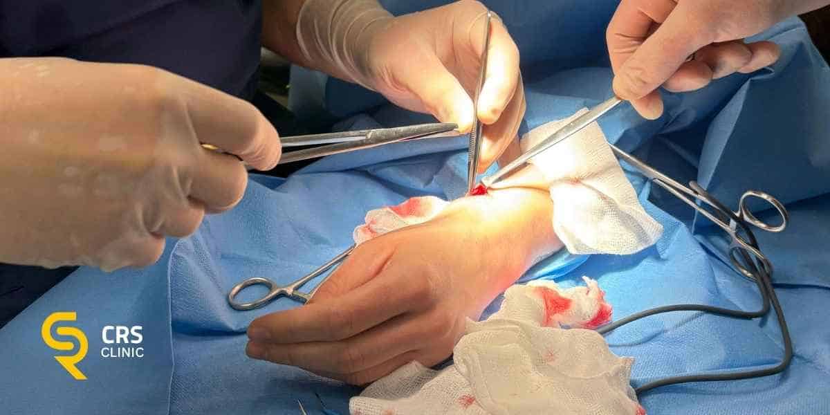 Lekarz ortopeda wykonuje operację cieśni nadgarstka w CRS Clinic Warszawa