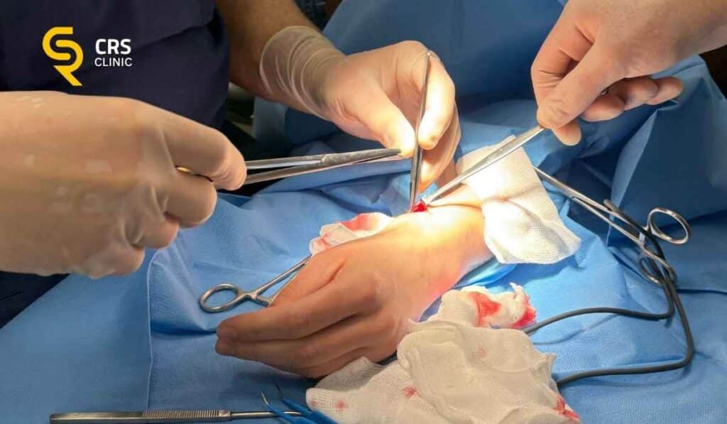 Lekarz ortopeda przeprowadza zabieg operacyjny w chorobie de Quervaina w CRS Clinic Warszawa