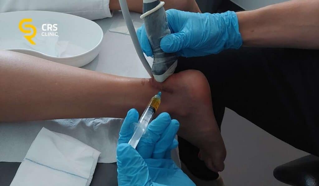 Lekarz ortopeda wykonuje iniekcję PRP pod kontrolą USG na ostrogę piętową w CRS Clinic Warszawa