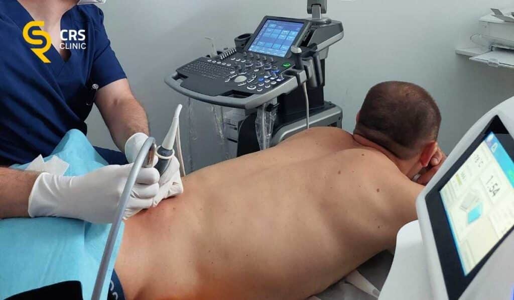 Lekarz ortopeda wykonuje zabieg kriolezji nerwów czuciowych w okolicy stawu krzyżowo-biodrowego w CRS Clinic Warszawa