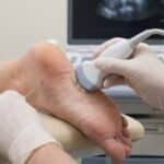 Lekarz ortopeda wykonuje zabieg sonochirurgiczny na ostrogę piętową w CRS Clinic Warszawa