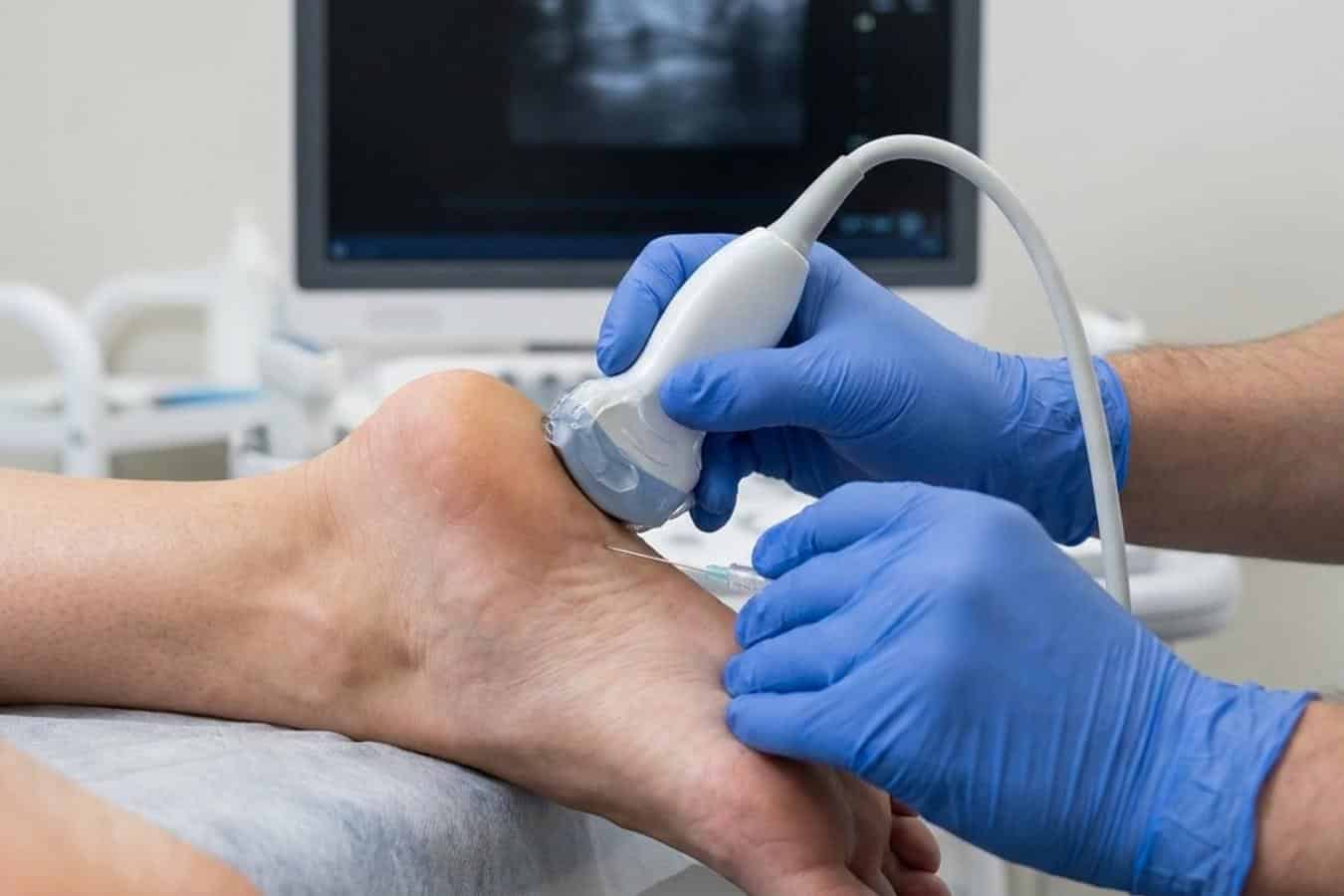 Lekarz ortopeda wykonuje zastrzyk sterydowy na ostrogę piętową w CRS Clinic Warszawa