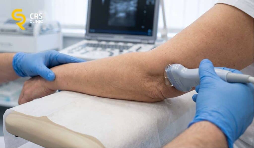 Ortopeda wykonuje diagnostykę USG u pacjenta z bólem łokcia w CRS Clinic Warszawa