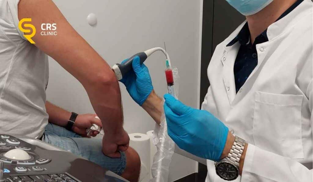 Ortopeda wykonuje iniekcję regeneracyjną osocza bogatopłytkowego łokcia w CRS Clinic Warszawa